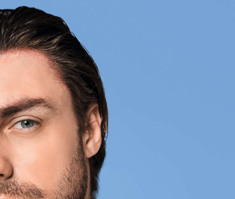 Ducray Kelual DS Şampuan kepek görünümünün azaltılmasına destek oluyor.